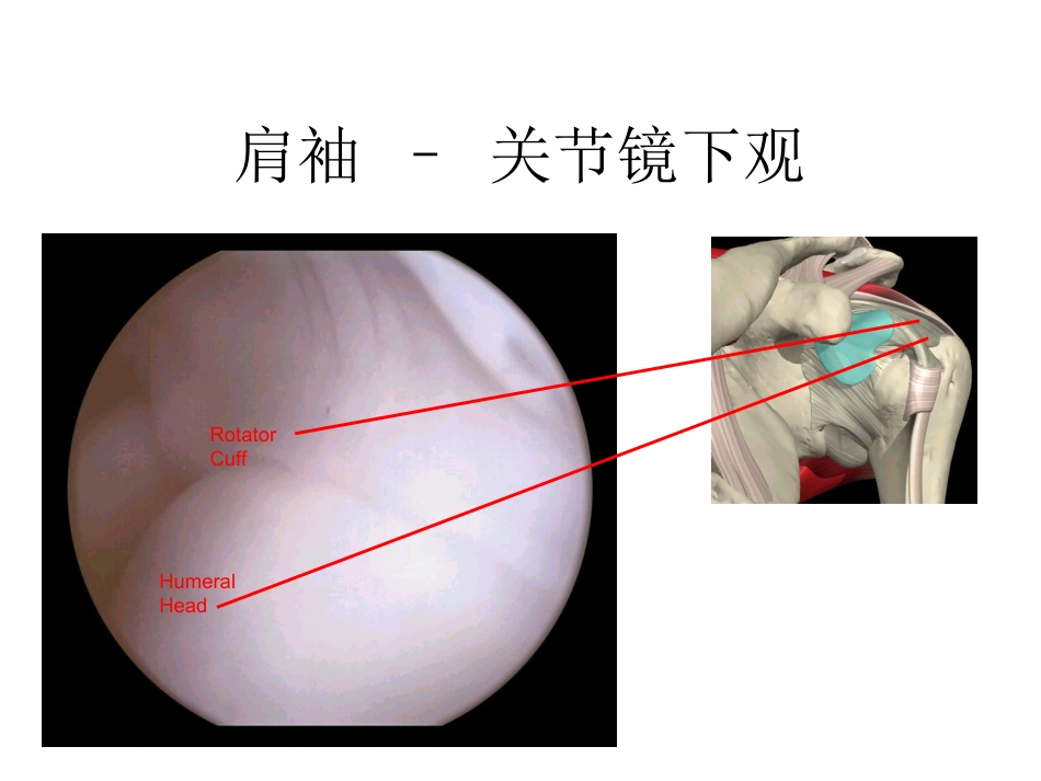 肩关节解剖入路及打结_第10页
