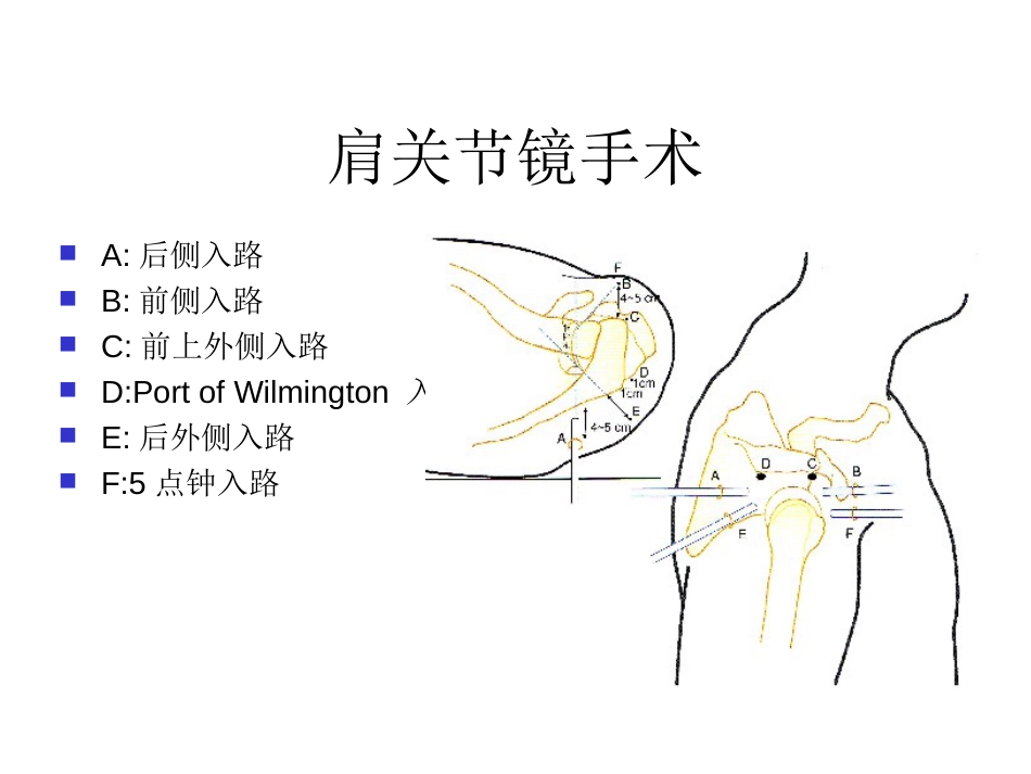 肩关节解剖入路及打结_第15页