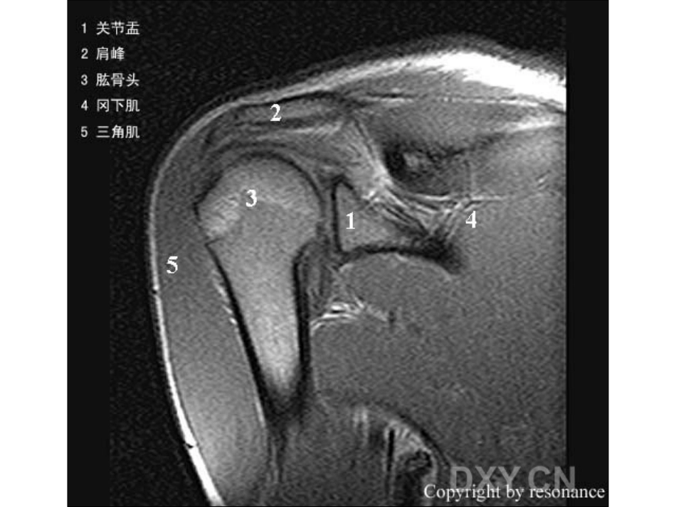 肩关节 正常MRI解剖图谱_第10页