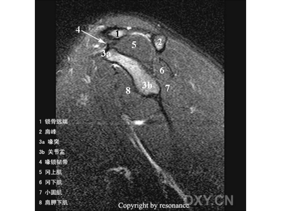 肩关节 正常MRI解剖图谱_第13页