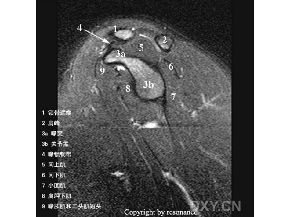 肩关节 正常MRI解剖图谱_第14页