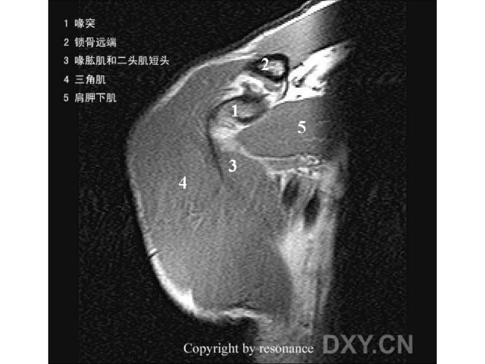 肩关节 正常MRI解剖图谱_第2页