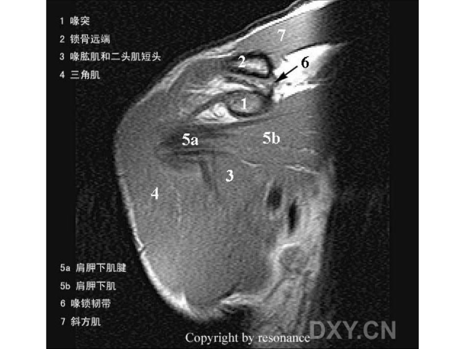 肩关节 正常MRI解剖图谱_第3页