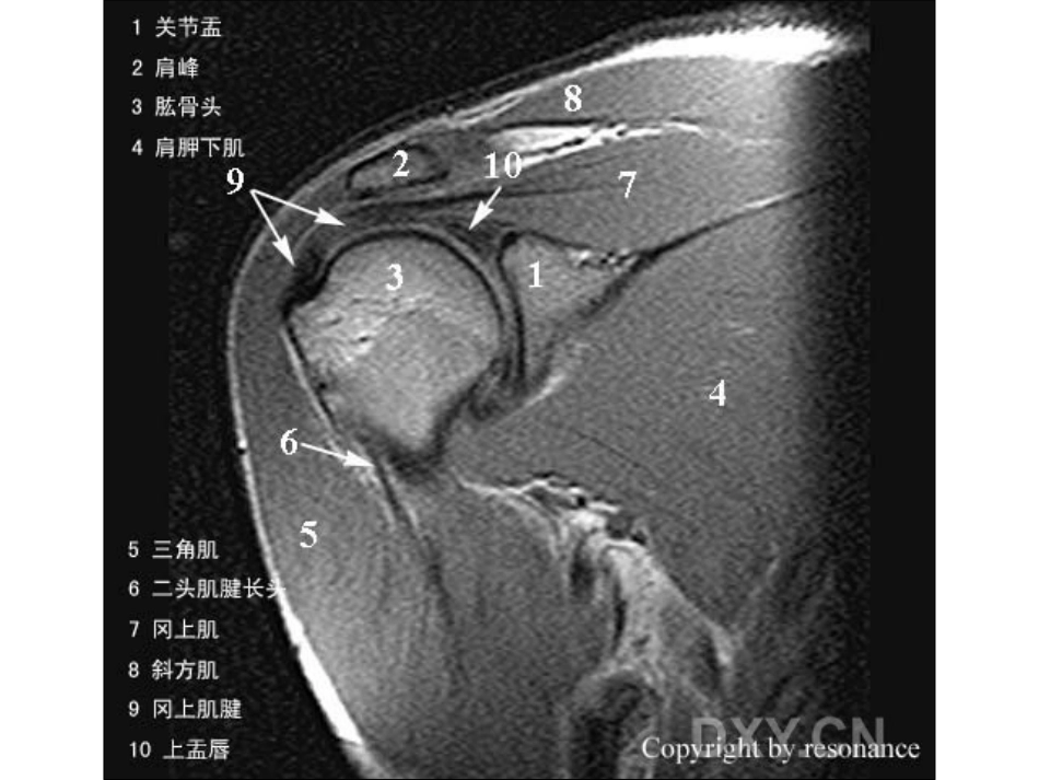 肩关节 正常MRI解剖图谱_第7页