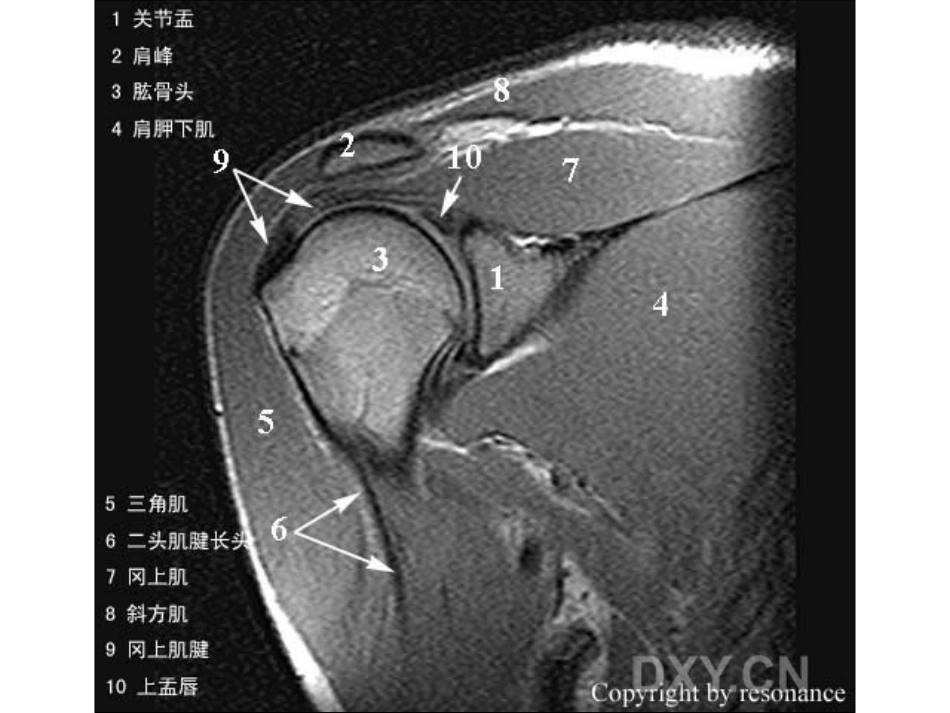 肩关节 正常MRI解剖图谱_第8页