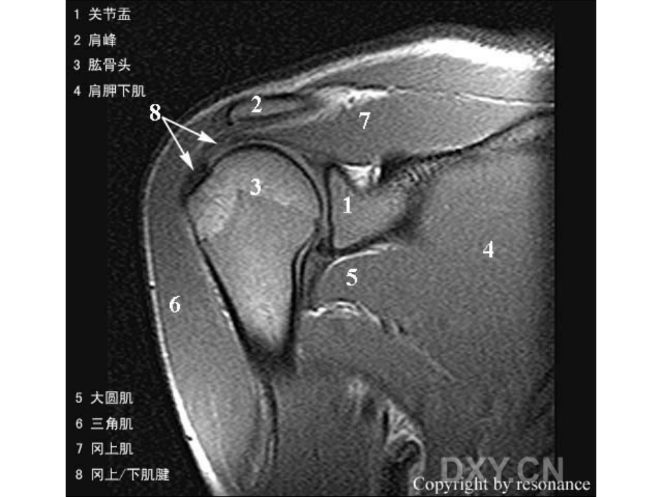 肩关节 正常MRI解剖图谱_第9页