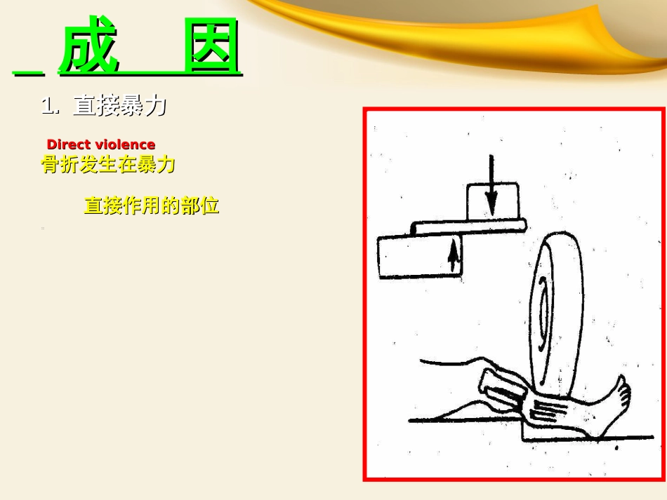 骨科实习小讲课_第6页