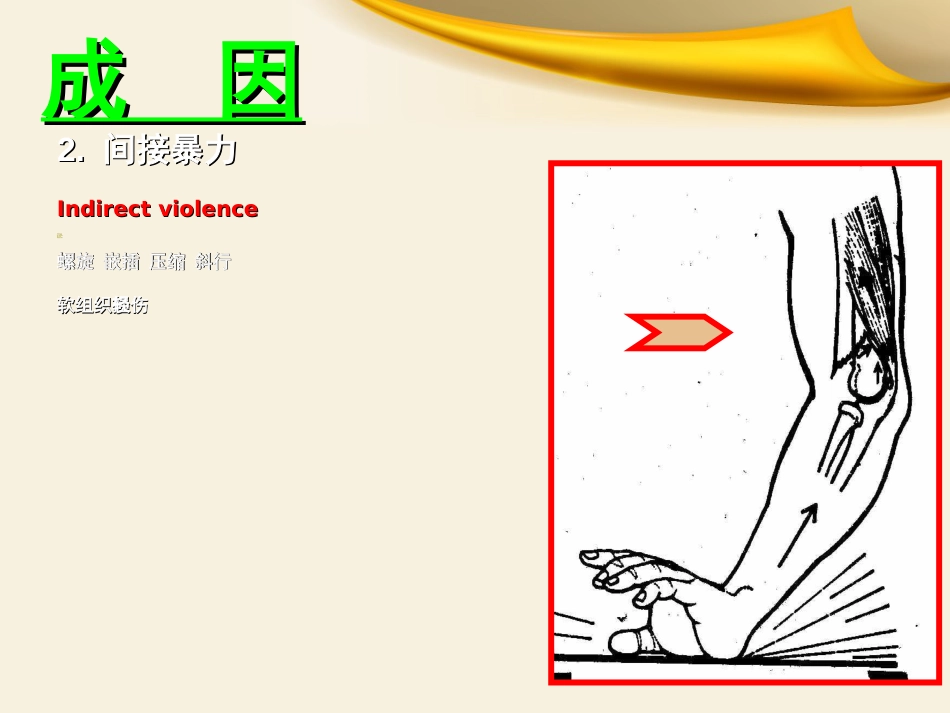 骨科实习小讲课_第7页