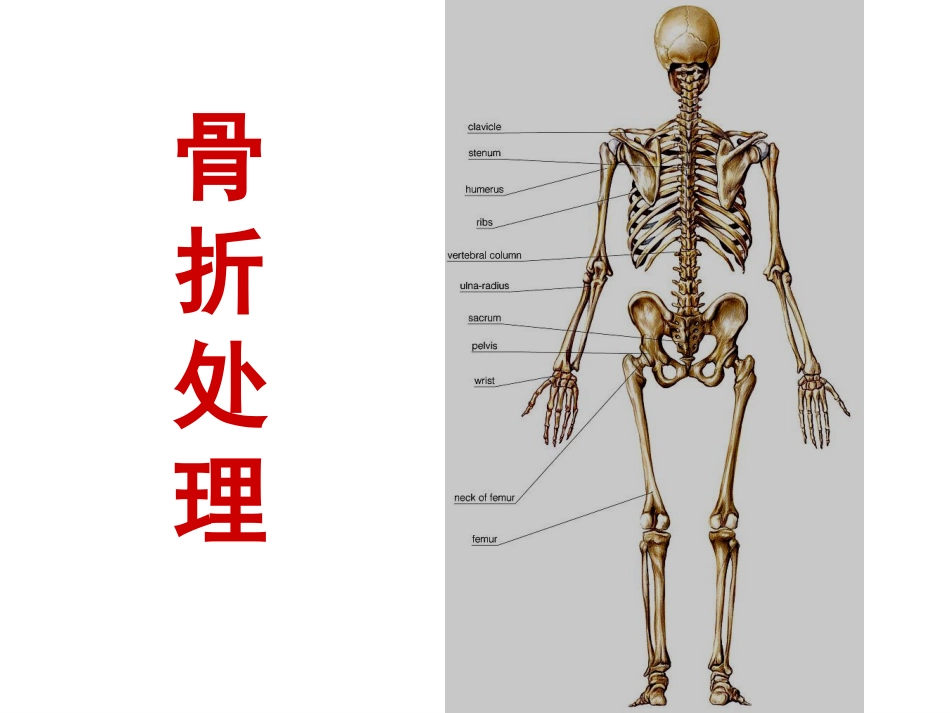 骨质疏松性 骨折_第14页