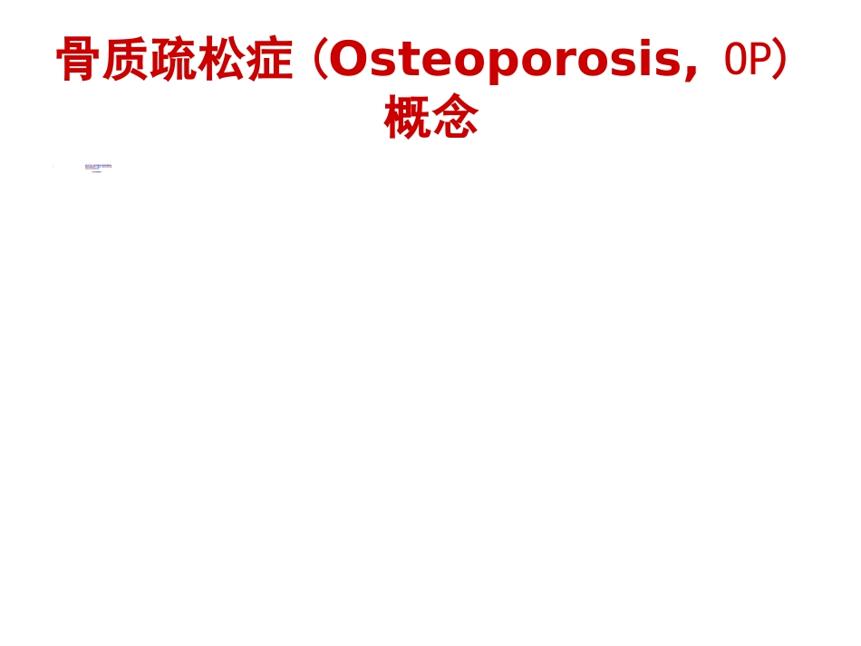 骨质疏松性 骨折_第3页
