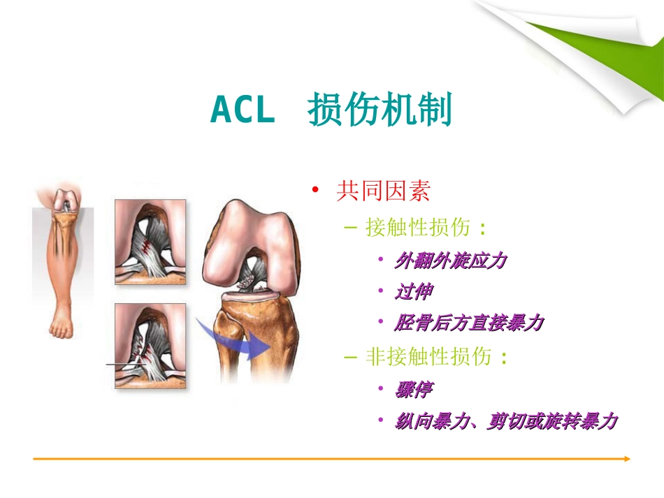 ACL 重建篇_第14页