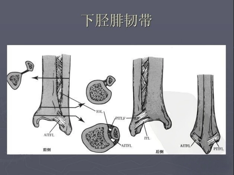 踝关节 骨折的分型2_第4页