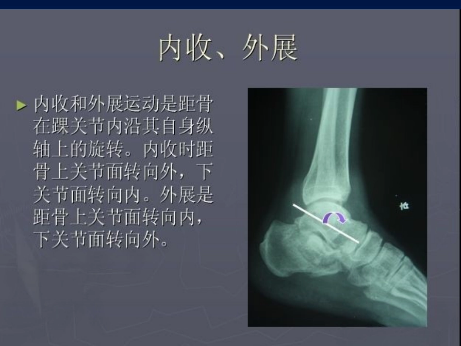 踝关节 骨折的分型2_第7页
