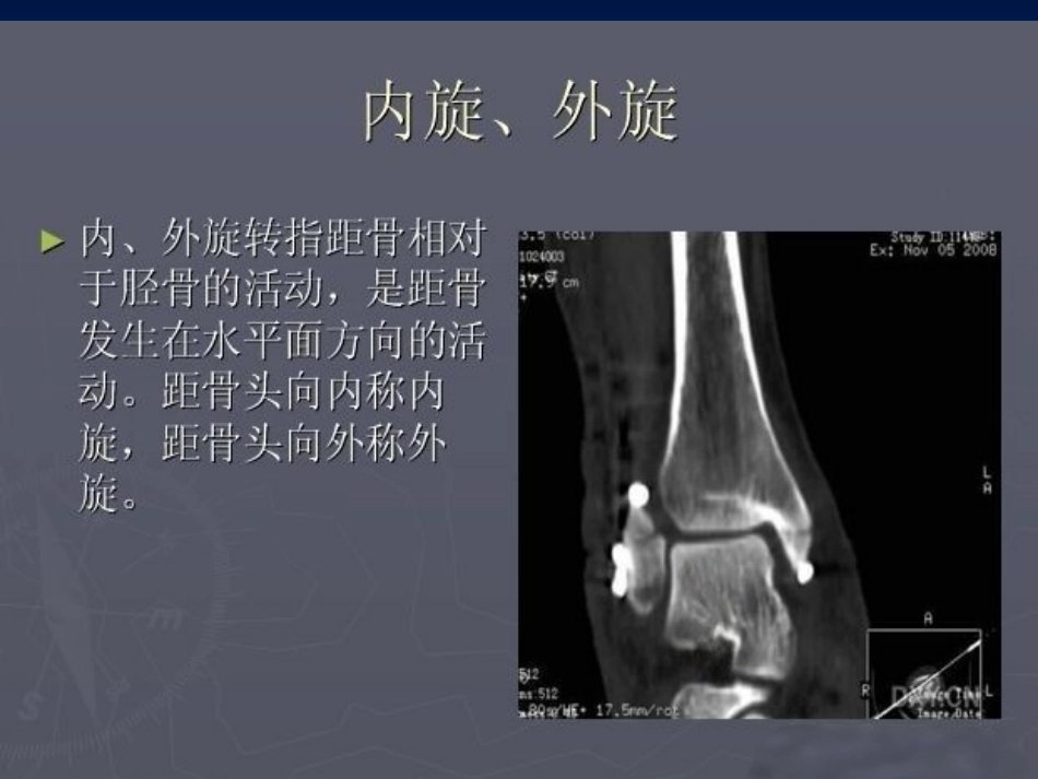 踝关节 骨折的分型2_第8页