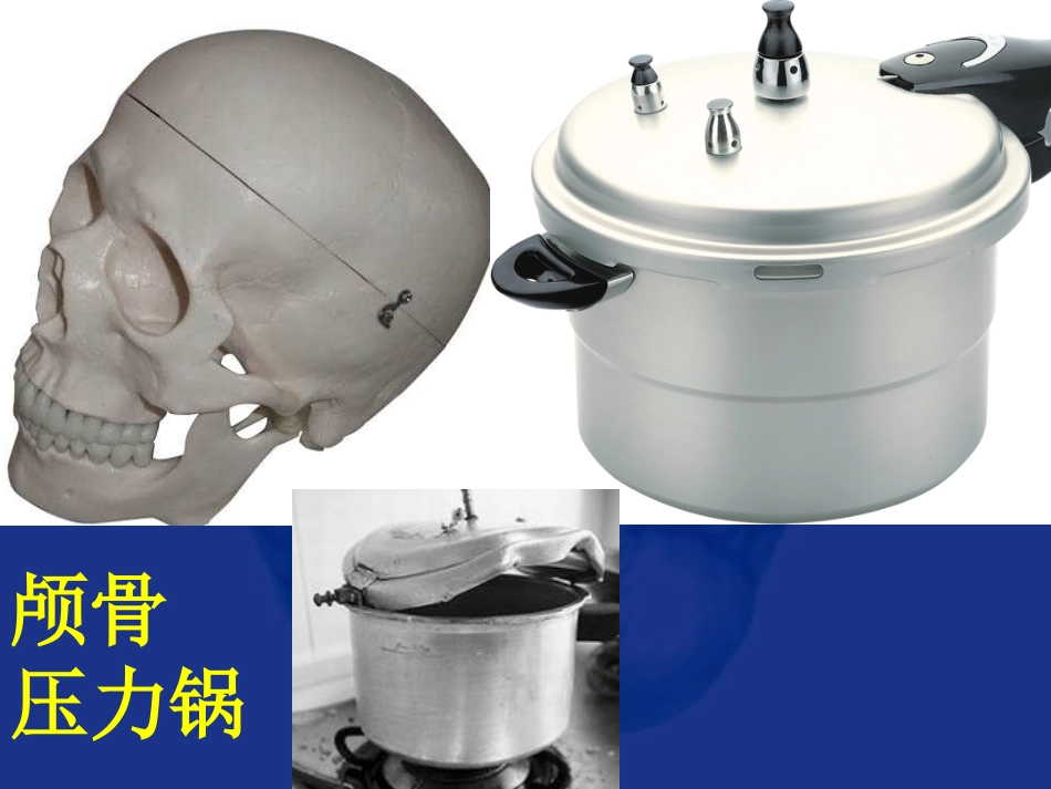 神经科-颅内压增高和脑疝_第3页