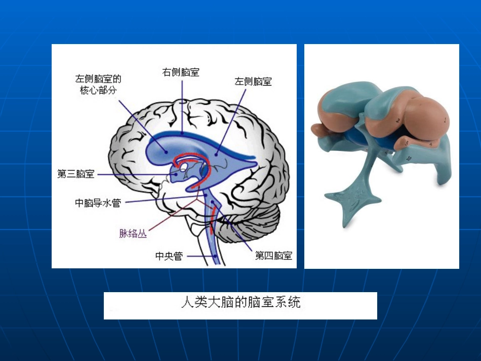 神经科-颅内压增高与脑疝_第13页
