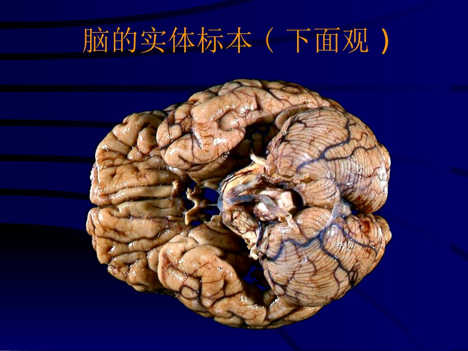 神经科-颅高压_第5页