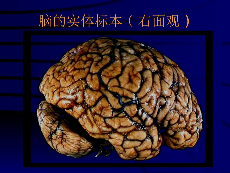 神经科-颅高压_第6页