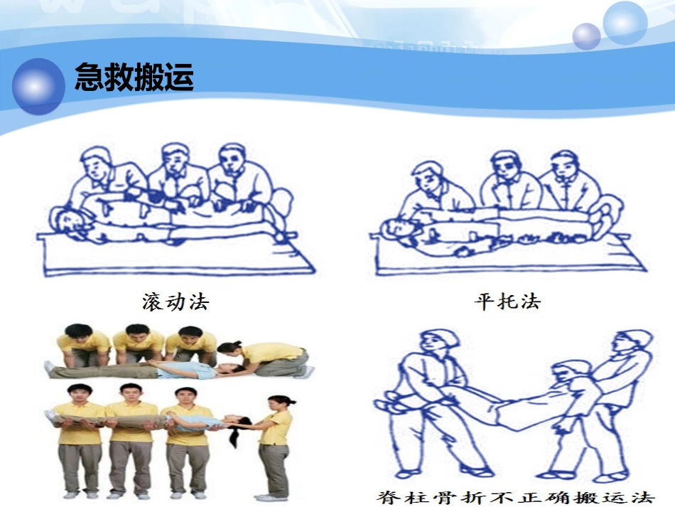 神经内科-脊柱脊髓损伤、骨盆骨折_第10页