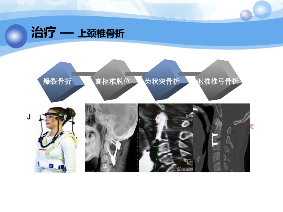 神经内科-脊柱脊髓损伤、骨盆骨折_第11页