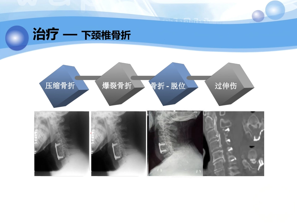 神经内科-脊柱脊髓损伤、骨盆骨折_第12页