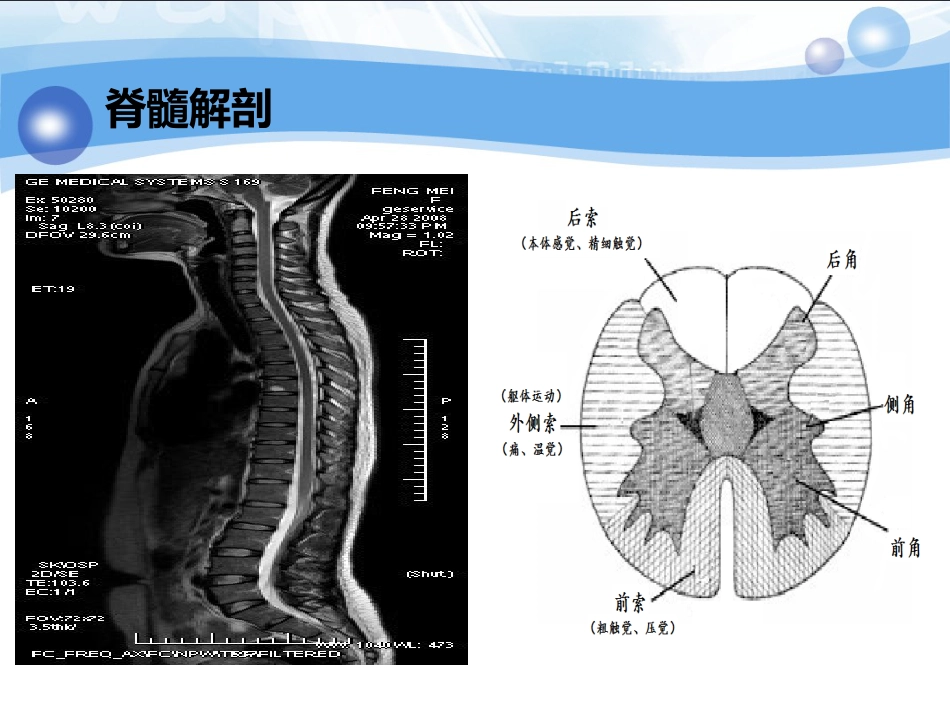 神经内科-脊柱脊髓损伤、骨盆骨折_第15页