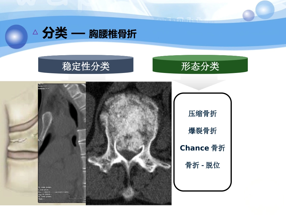 神经内科-脊柱脊髓损伤、骨盆骨折_第7页