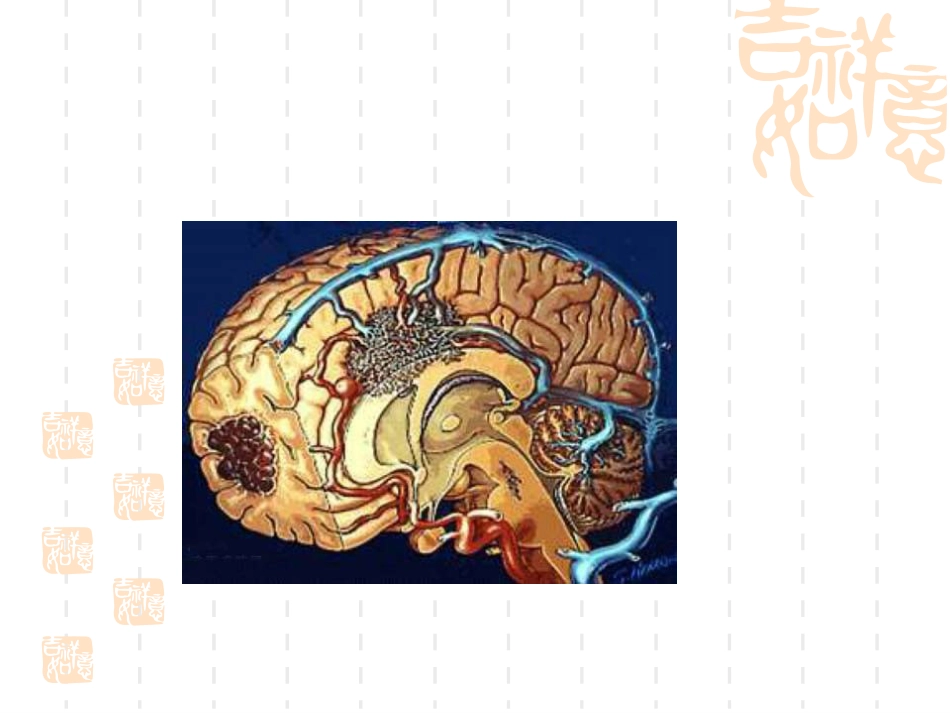 神经内科脑血栓_第2页