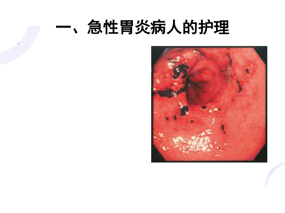 胃炎的护理_第4页