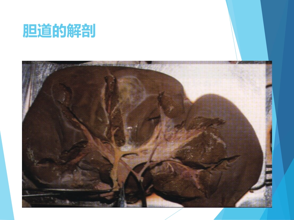 外科-胆道疾病_第8页