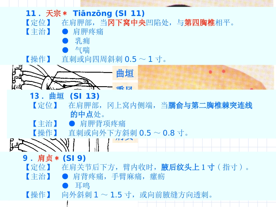 人体经络穴位图谱6小肠经_第11页