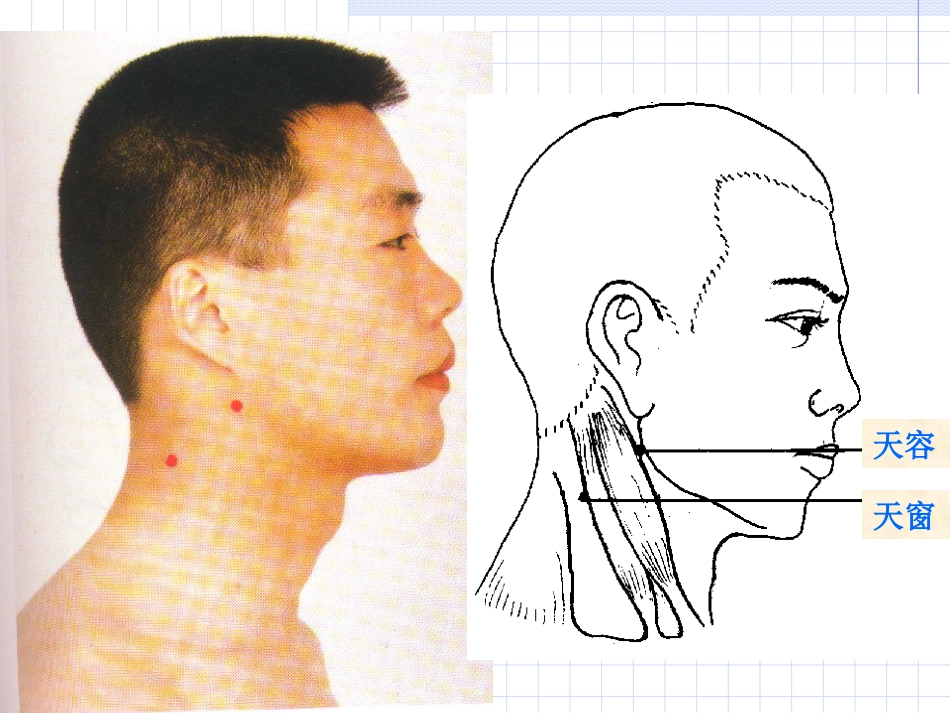 人体经络穴位图谱6小肠经_第13页