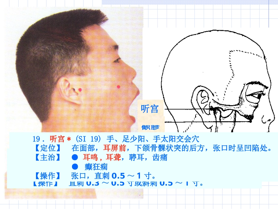 人体经络穴位图谱6小肠经_第14页