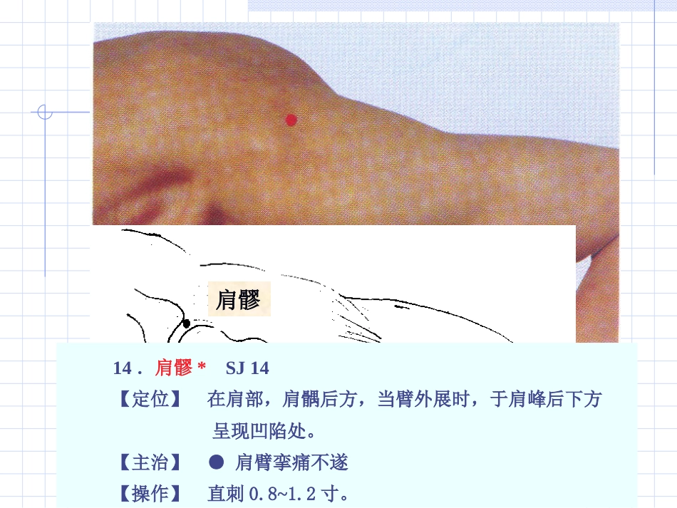 人体经络穴位图谱10三焦经_第10页