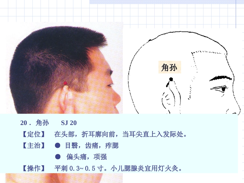 人体经络穴位图谱10三焦经_第13页