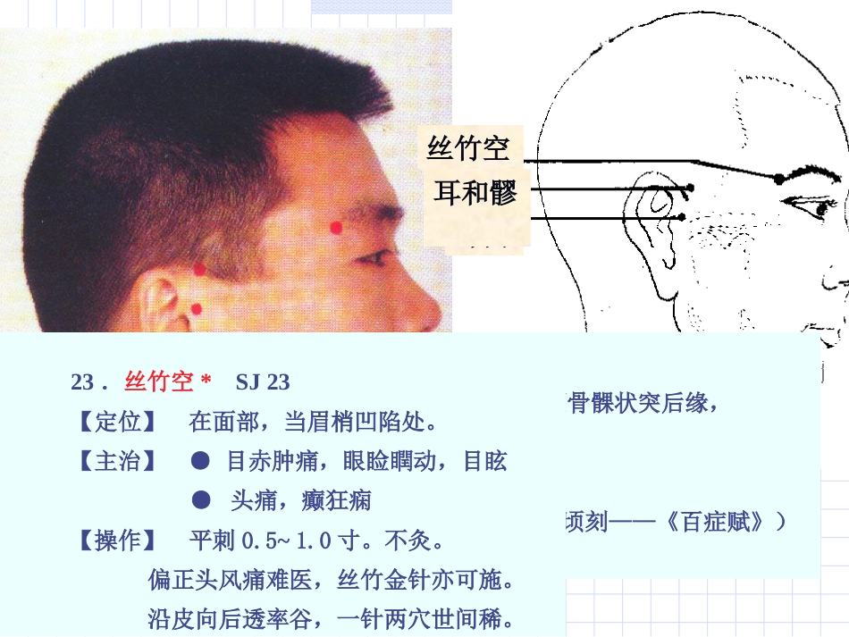 人体经络穴位图谱10三焦经_第14页