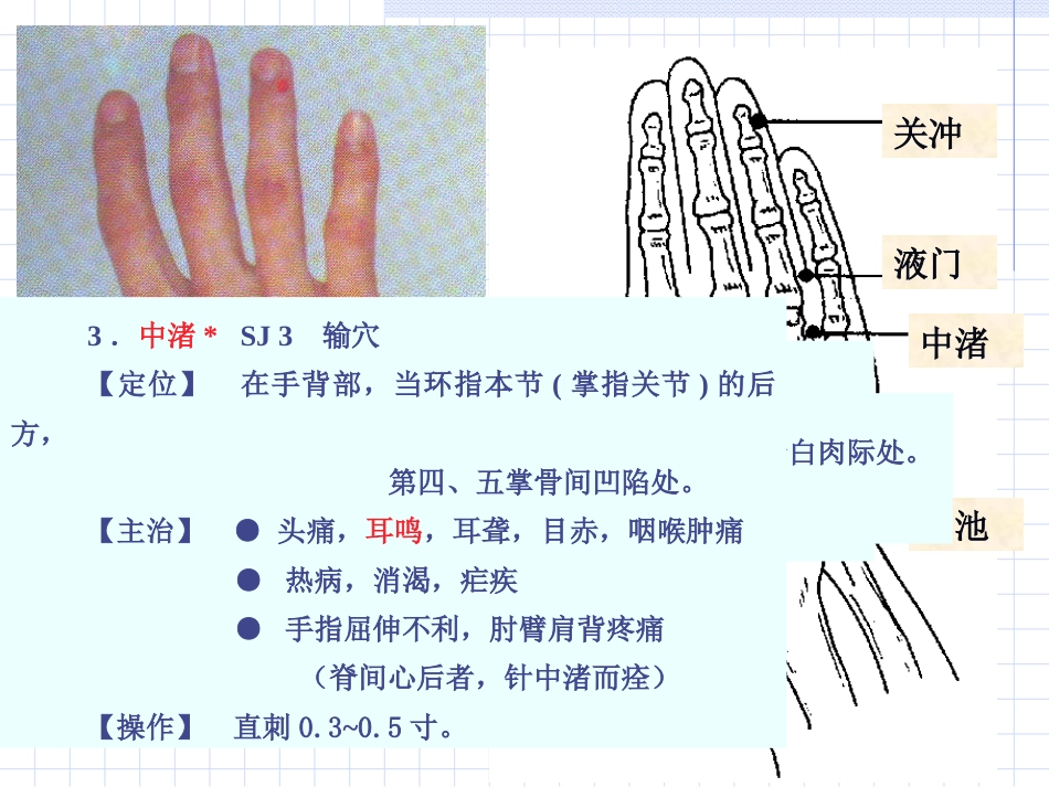 人体经络穴位图谱10三焦经_第6页