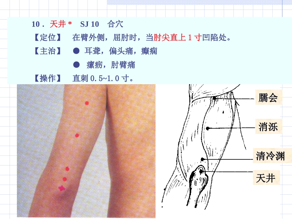 人体经络穴位图谱10三焦经_第9页