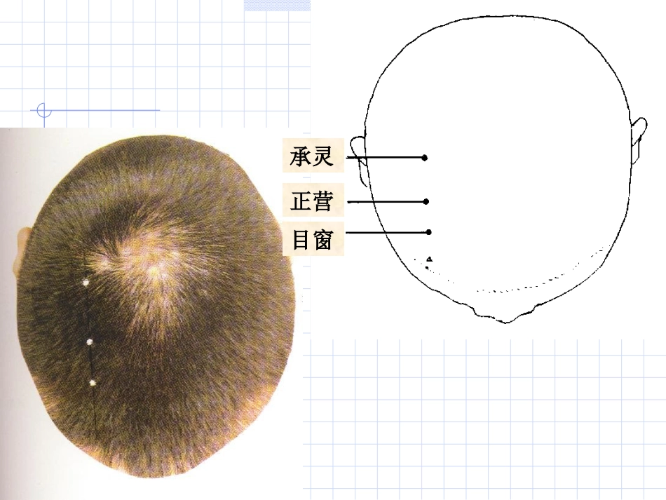人体经络穴位图谱11胆经_第12页