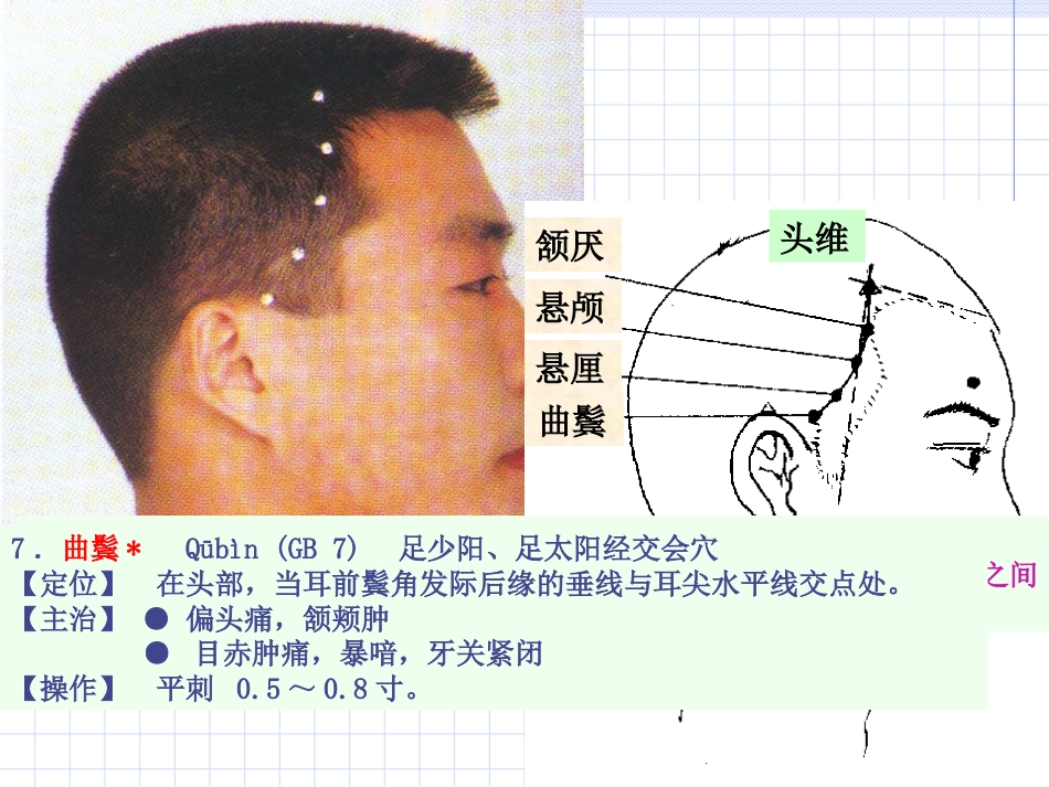 人体经络穴位图谱11胆经_第9页