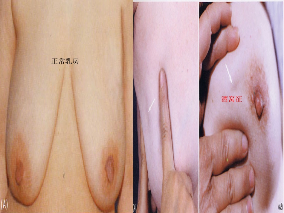 乳腺外科-乳腺_第12页
