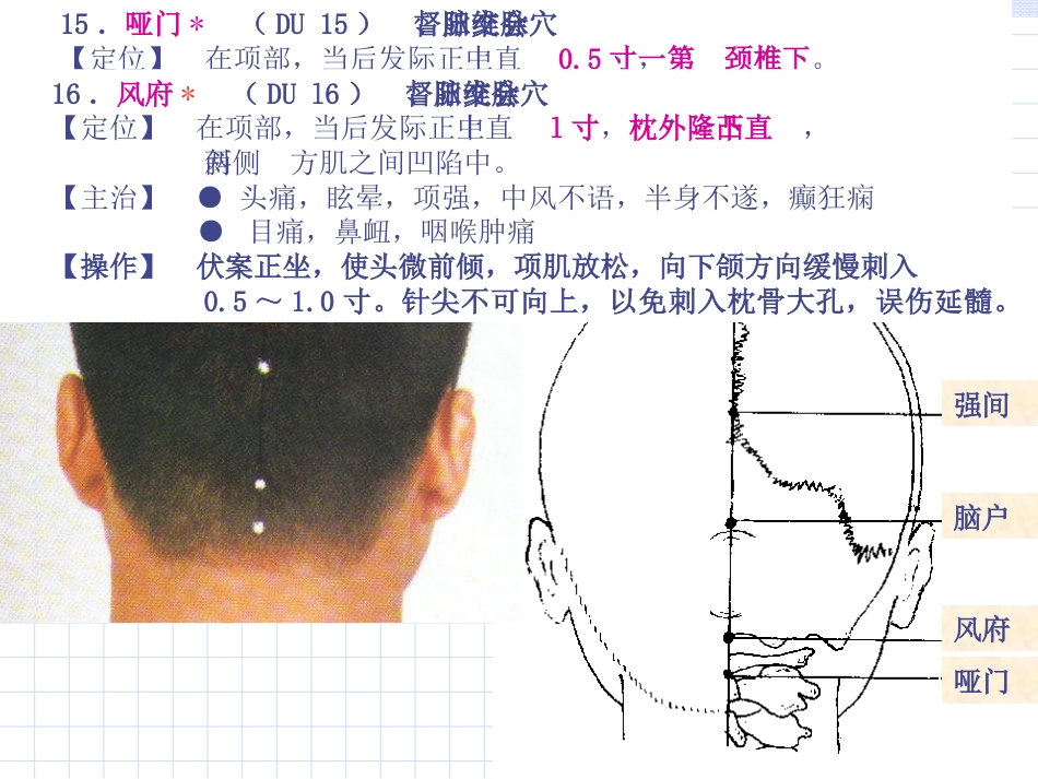 人体经络穴位图谱13督脉_第13页