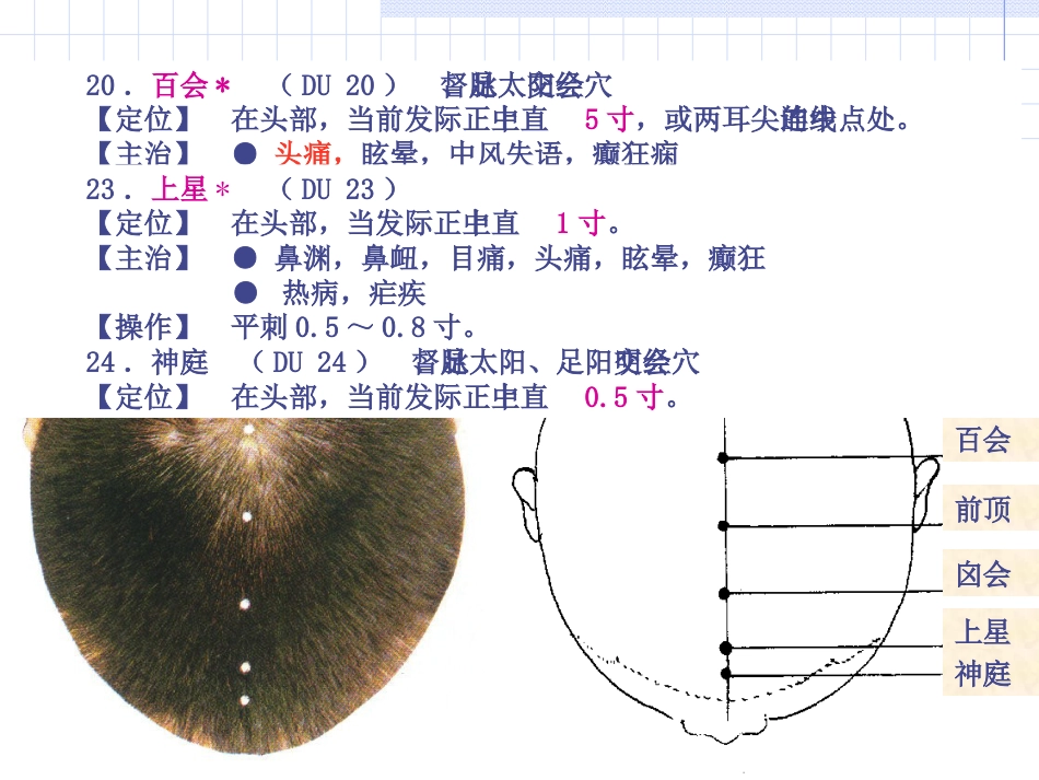 人体经络穴位图谱13督脉_第14页