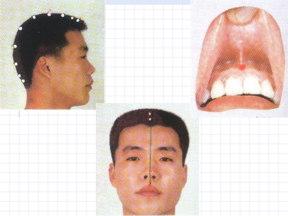 人体经络穴位图谱13督脉_第8页