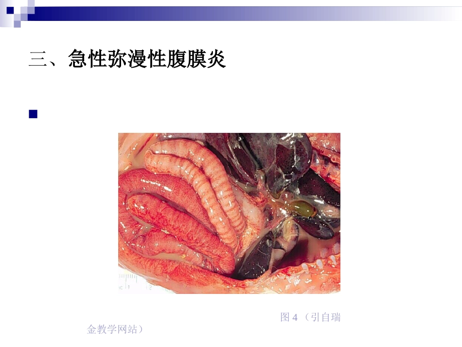 普外科-急性化脓性腹膜炎_第12页