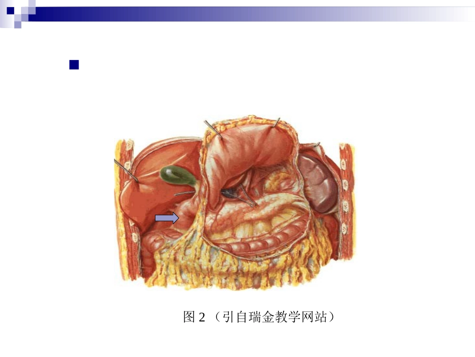 普外科-急性化脓性腹膜炎_第4页