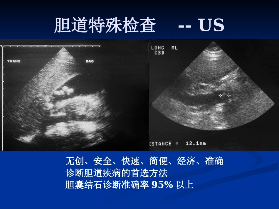 外科--胆道疾病_第13页