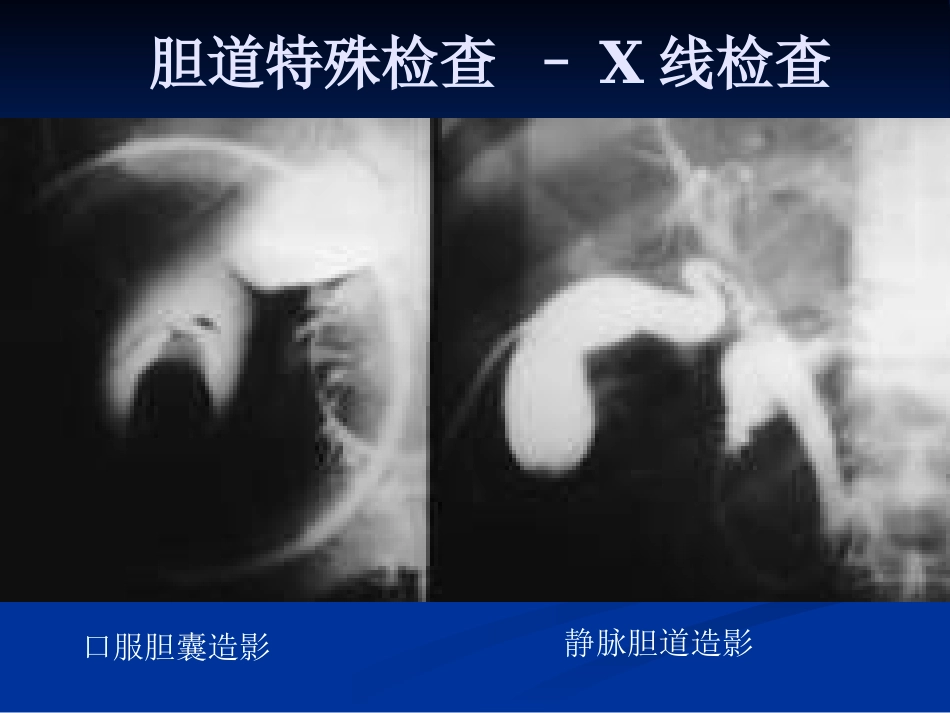 外科--胆道疾病_第14页