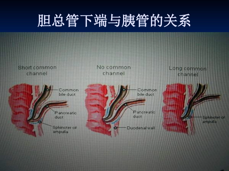 外科--胆道疾病_第7页