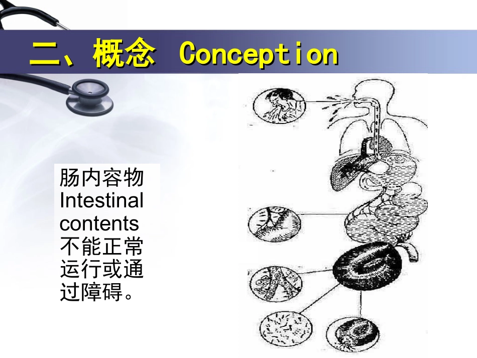 胃肠外科-肠梗阻_第3页